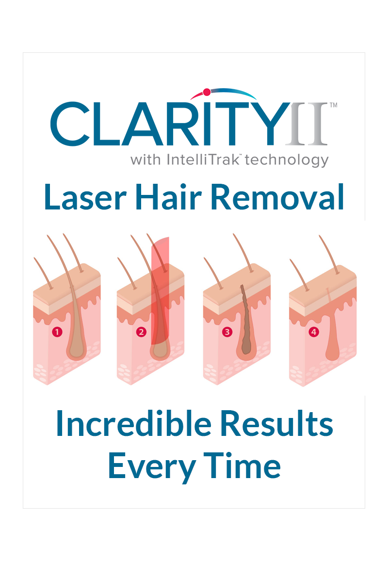 Laser Hair Removal Basel - The Best & Safest Results for your Skin